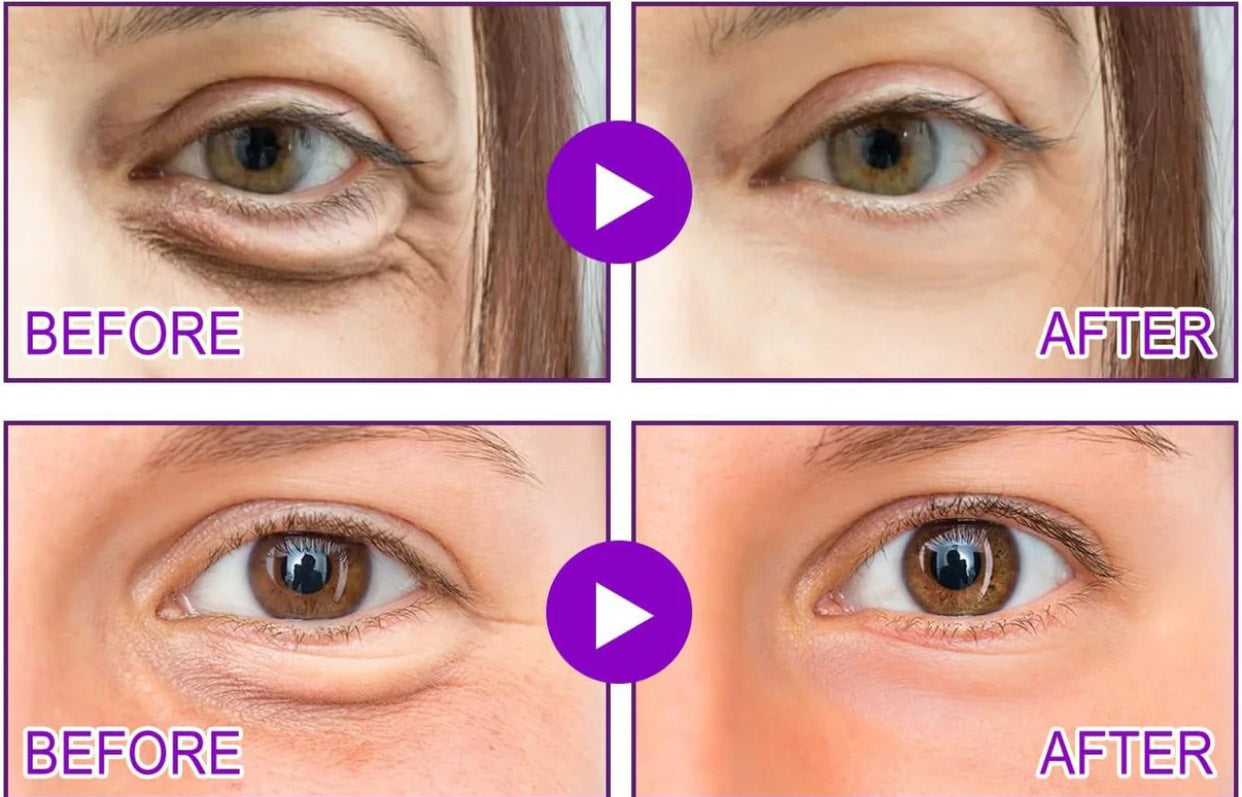 MicroGlow Patches by PureAura